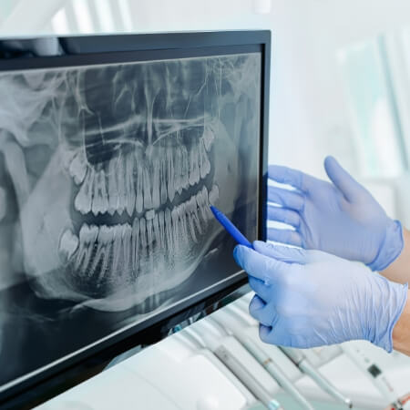 Dentist pointing to all digital x rays
