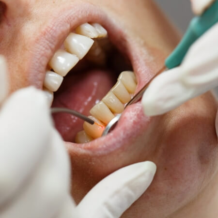 Dentist providing soft tissue laser dentistry treatment