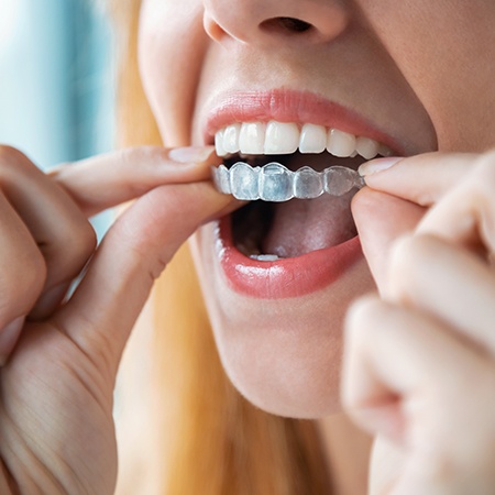a close-up of a clear aligner
