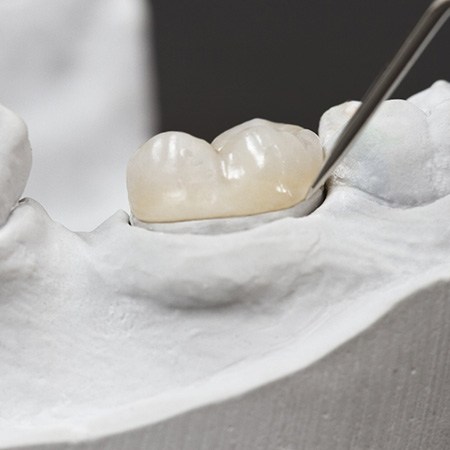 dental crown on model teeth