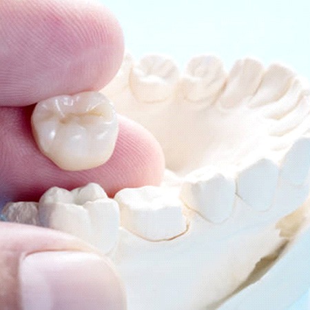 Close up of dental crown held in fingertips