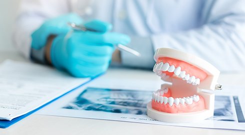 Dentist in blue gloves at a desk with papers, x-ray, and false teeth