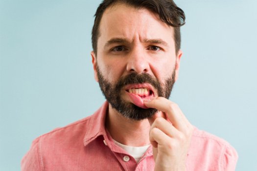 Man pulling down lower lip to reveal darkened gums