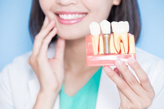Woman with curly brown hair smiling with shade guide held to teeth