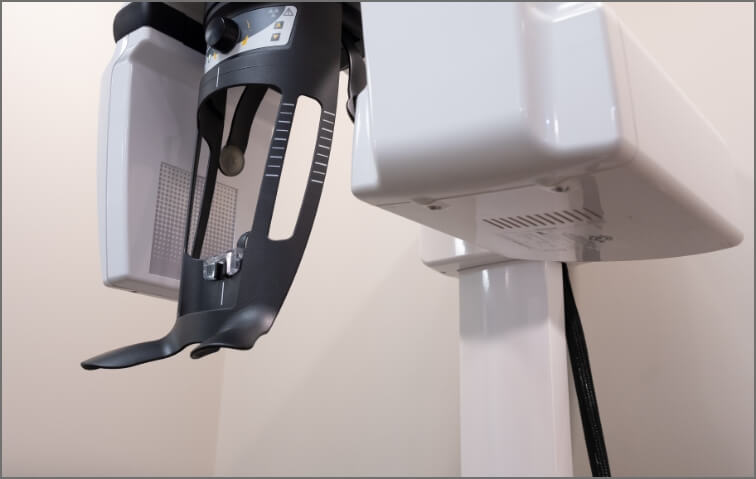 3 D C T cone beam digital x ray scanner