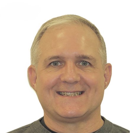 Smile with metal fillings before treatment and tooth colored fillings after