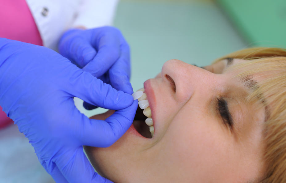 Patient having veneers placed